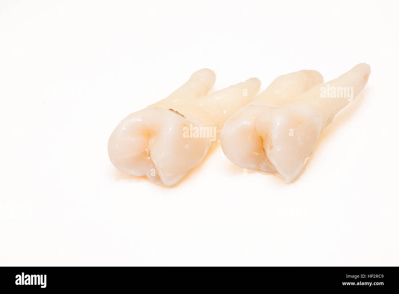 Close-up di denti umani su sfondo bianco Foto Stock