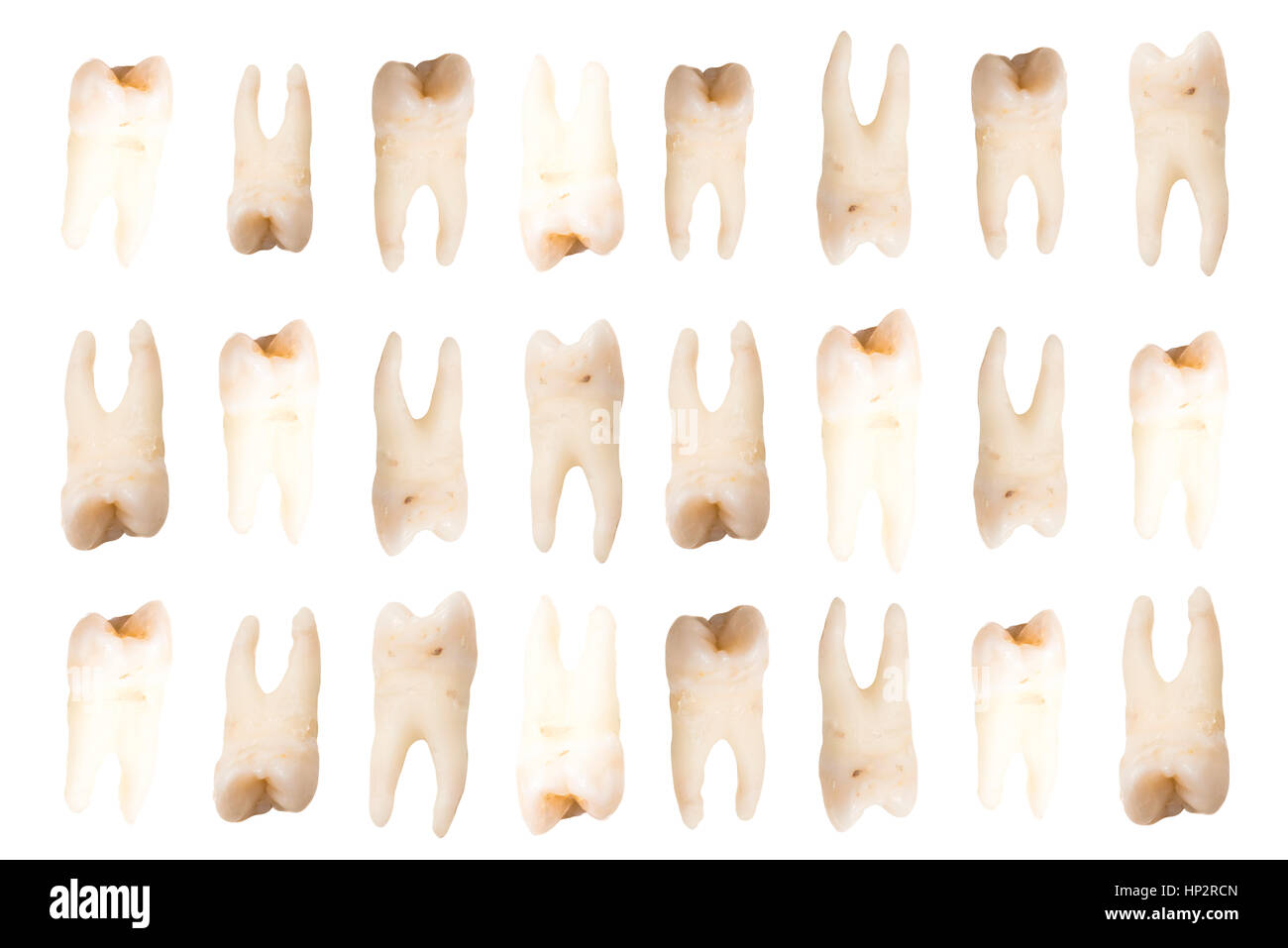 Close-up di denti umani su uno sfondo bianco,collage Foto Stock