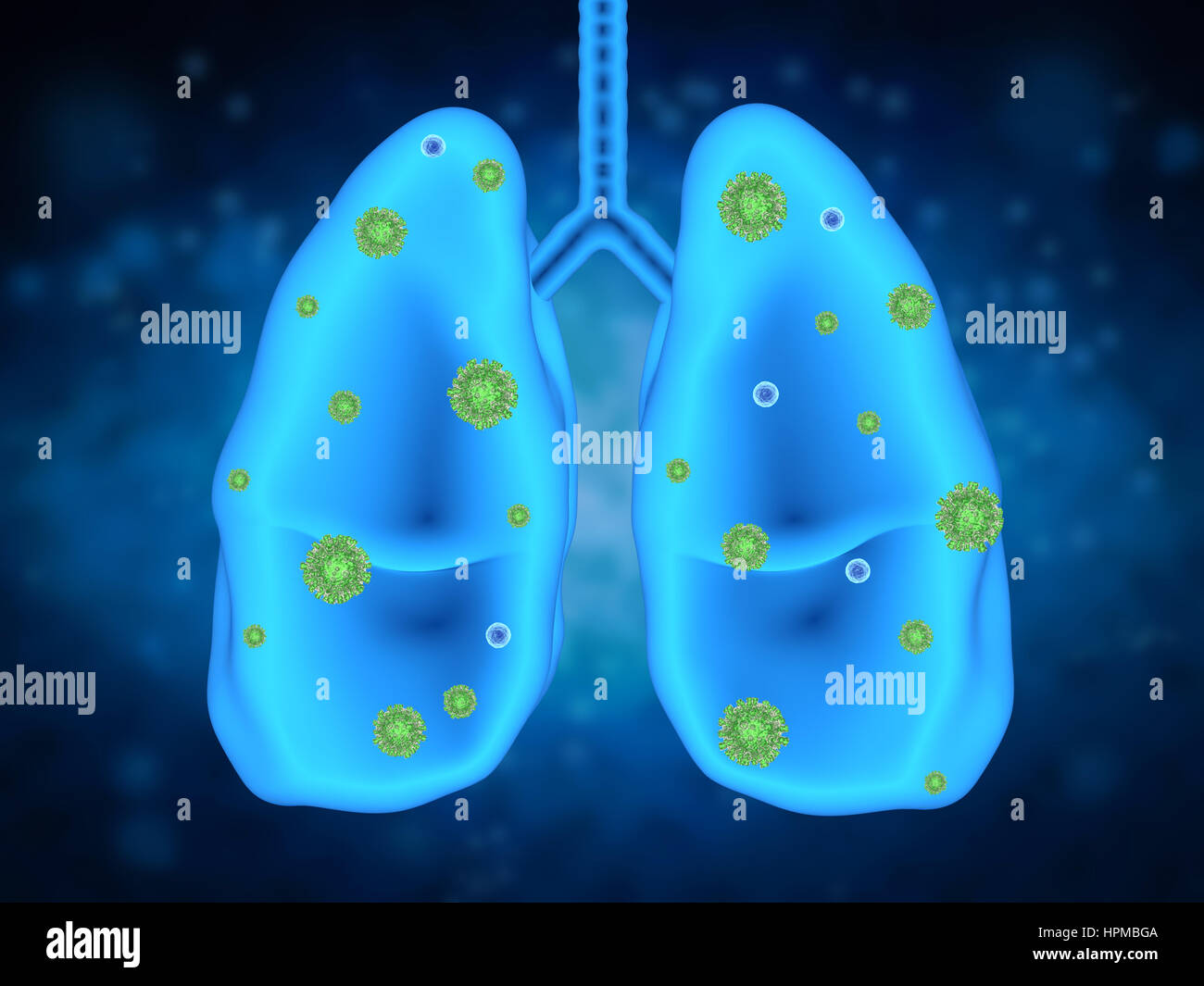 Il rendering 3d una malattia polmonare con cellule di batteri Foto Stock