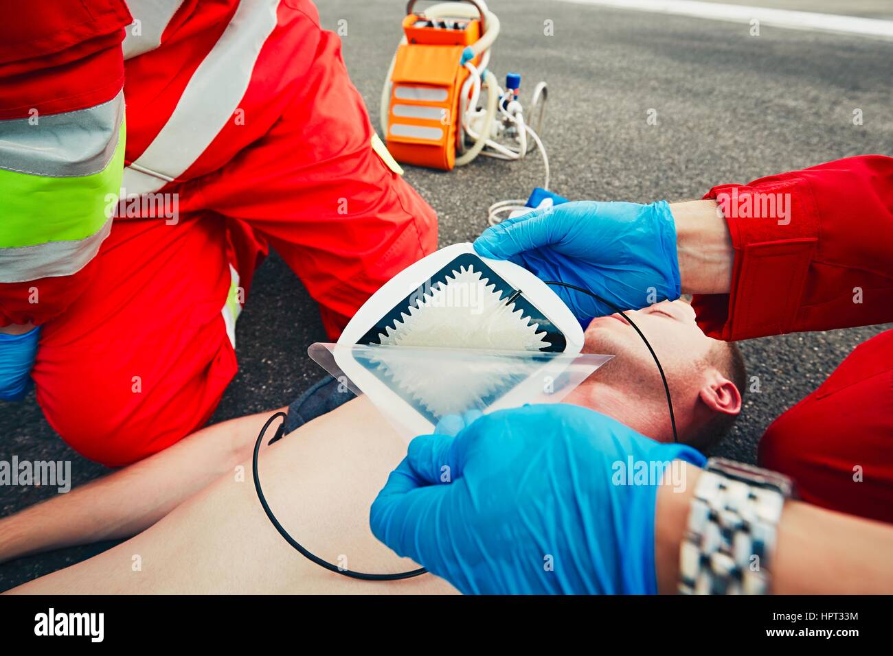 Gli elettrodi del defibrillatore. Squadra di salvataggio (medico e paramedico) resuscita l uomo sulla strada. Foto Stock