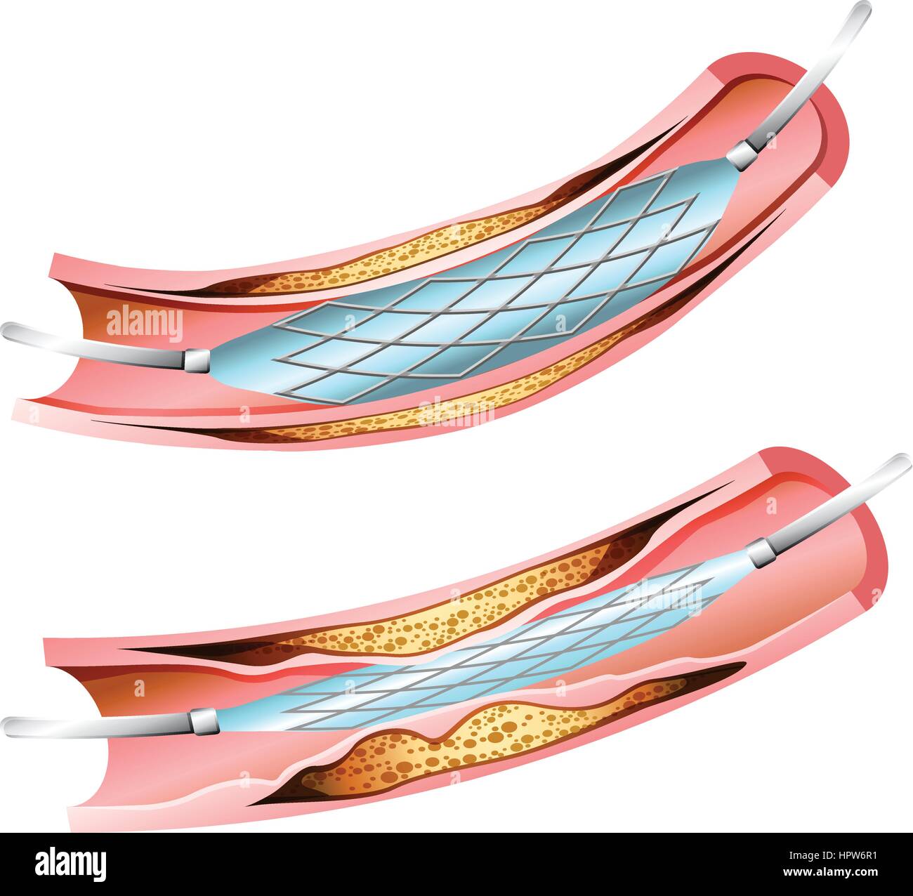 Illustrazione per la sacca di sangue Illustrazione Vettoriale