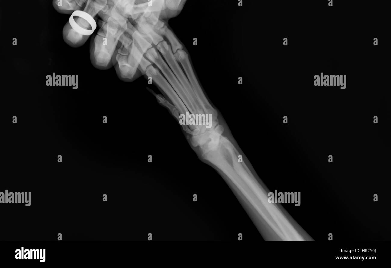 Raggi X di un cane anteriori della gamba sinistra presso un ambulatorio veterinario il tecnico la mano che tiene la zampa può essere visto Foto Stock