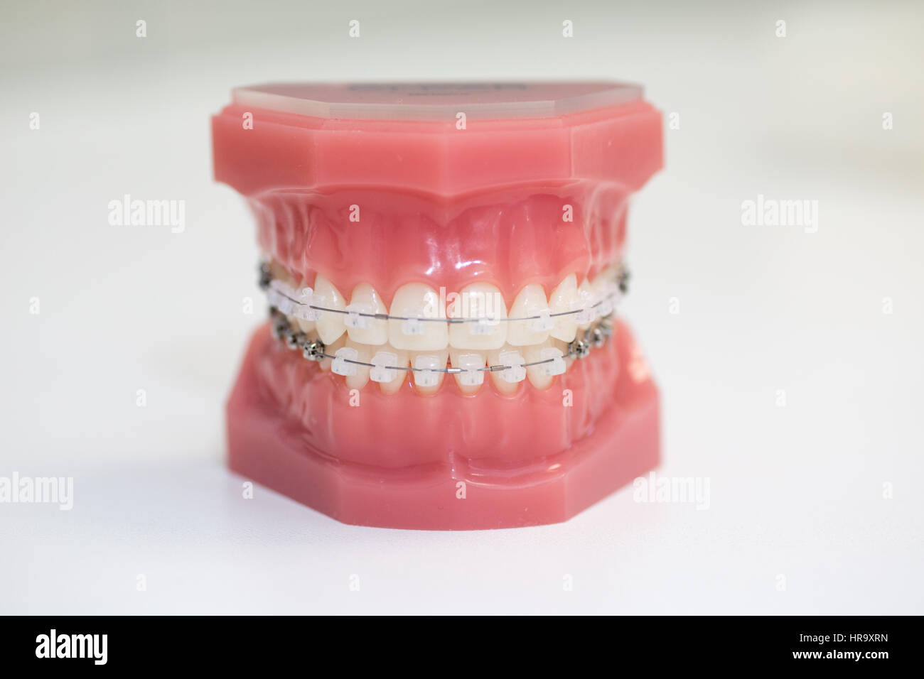 Modelli ortodontico dentale, cancellare il rinforzo Foto Stock