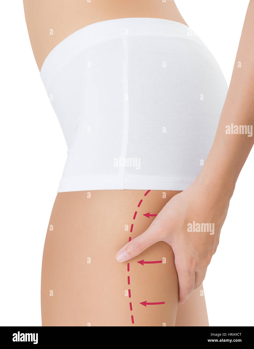 Donna di spremitura coscia posteriore con il disegno frecce rosse, perdere peso e liposuzione cellulite distacco concetto, isolati su sfondo bianco. Foto Stock
