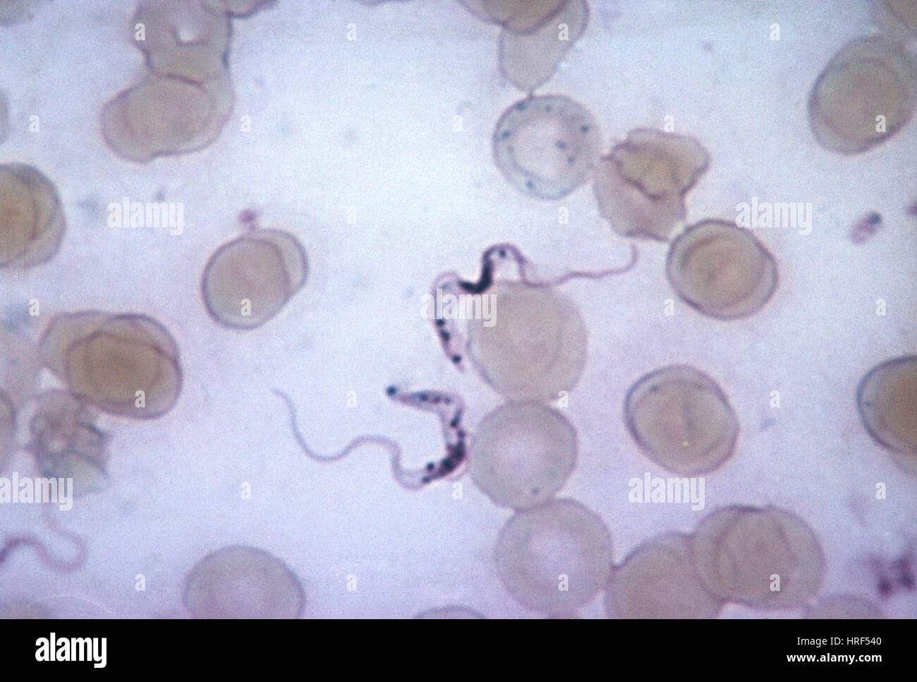 Trypanosoma gambiense Foto Stock