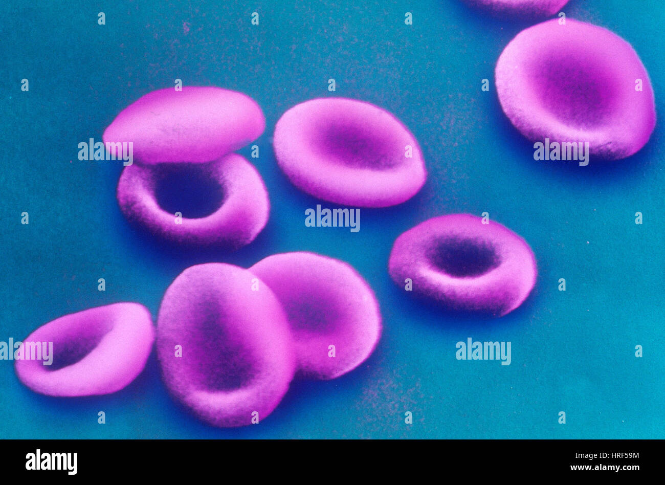 Le cellule rosse del sangue, SEM Foto Stock