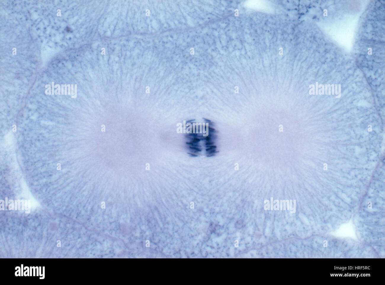 Whitefish cellule in Anaphase, LM Foto Stock