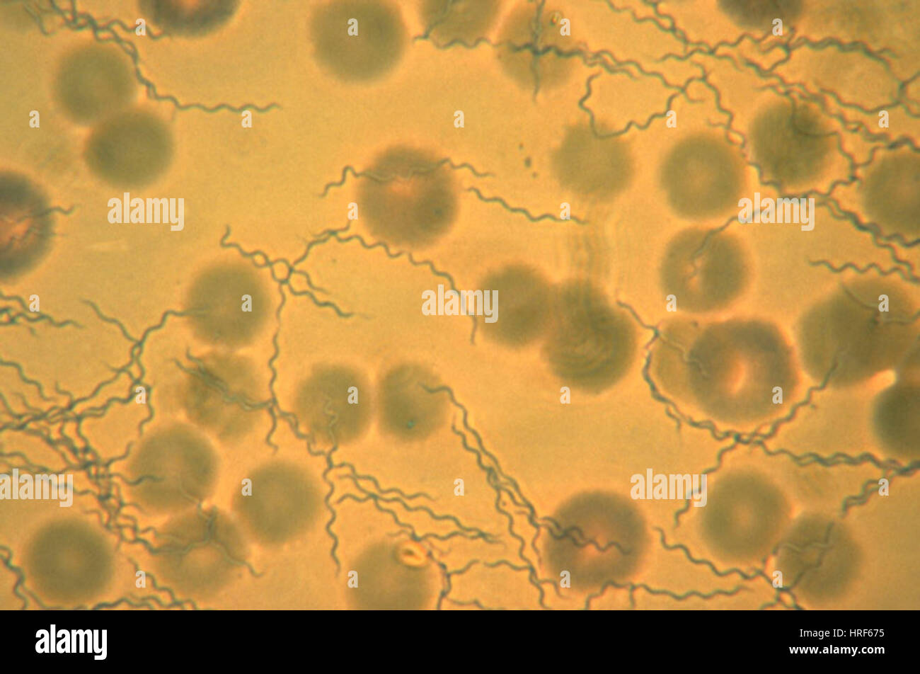 Borrelia recurrentis Foto Stock