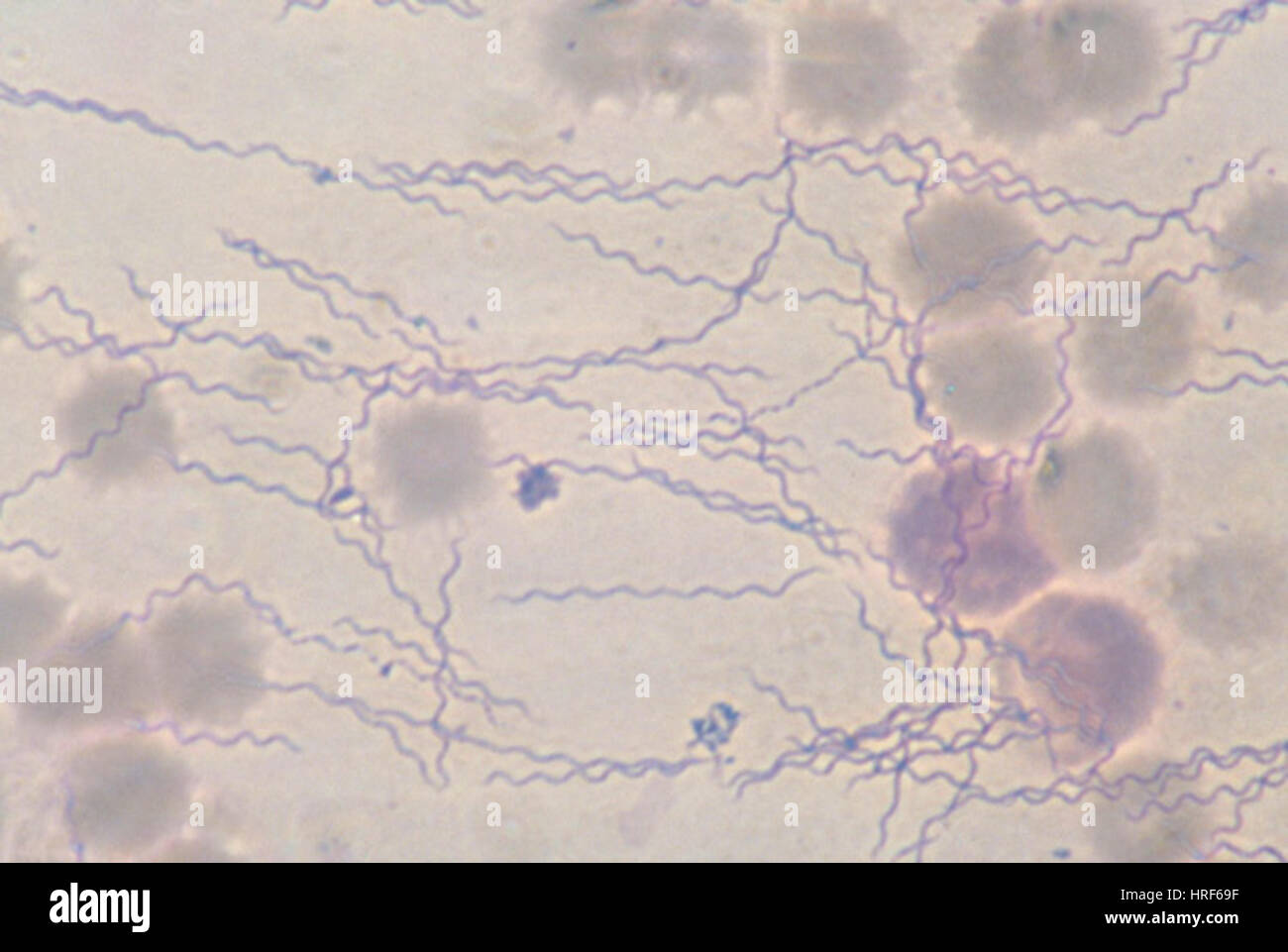 Borrelia recurrentis Foto Stock