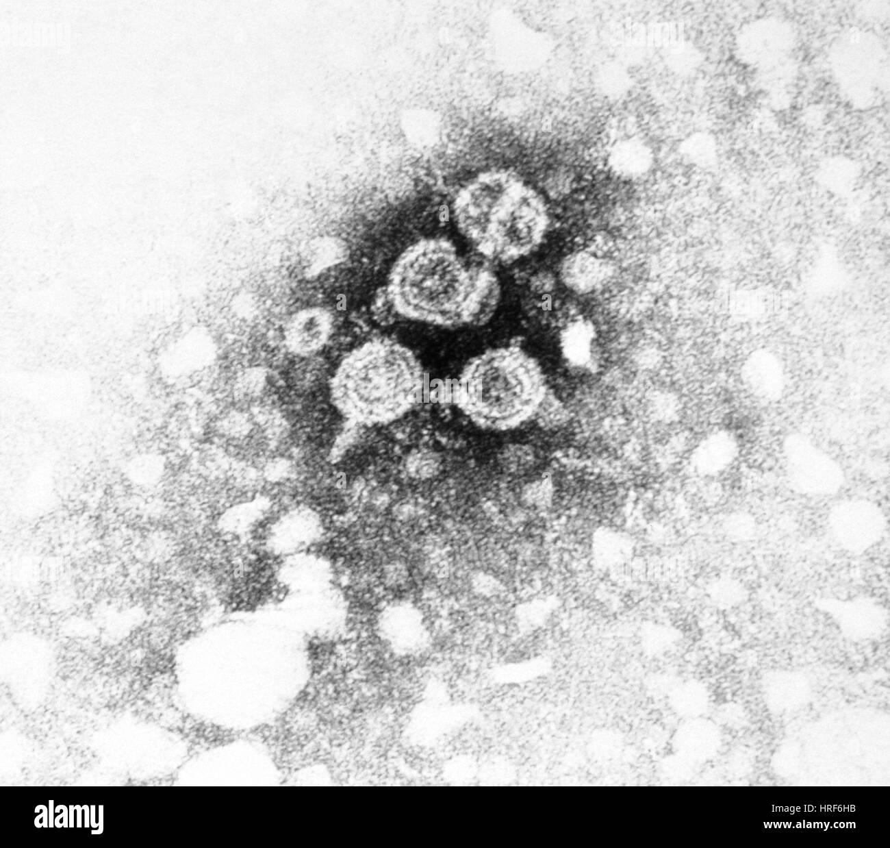 L'epatite B, TEM Foto Stock
