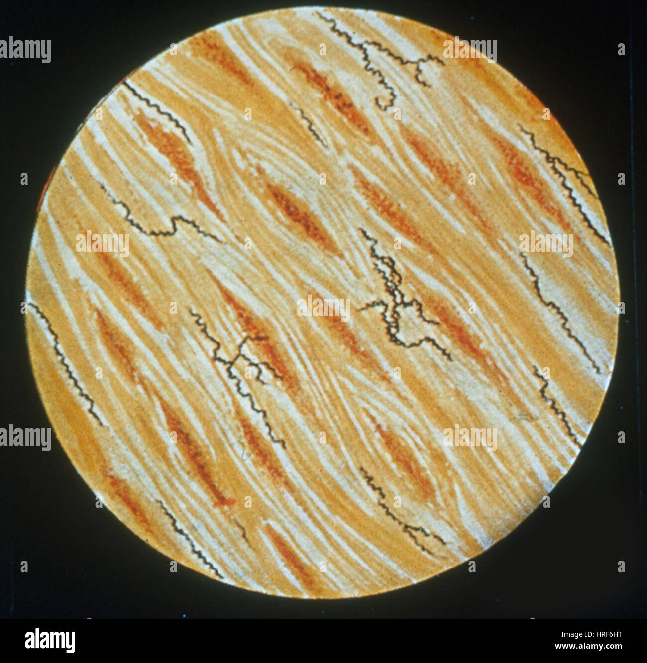Treponema pallidum immagini e fotografie stock ad alta risoluzione - Alamy