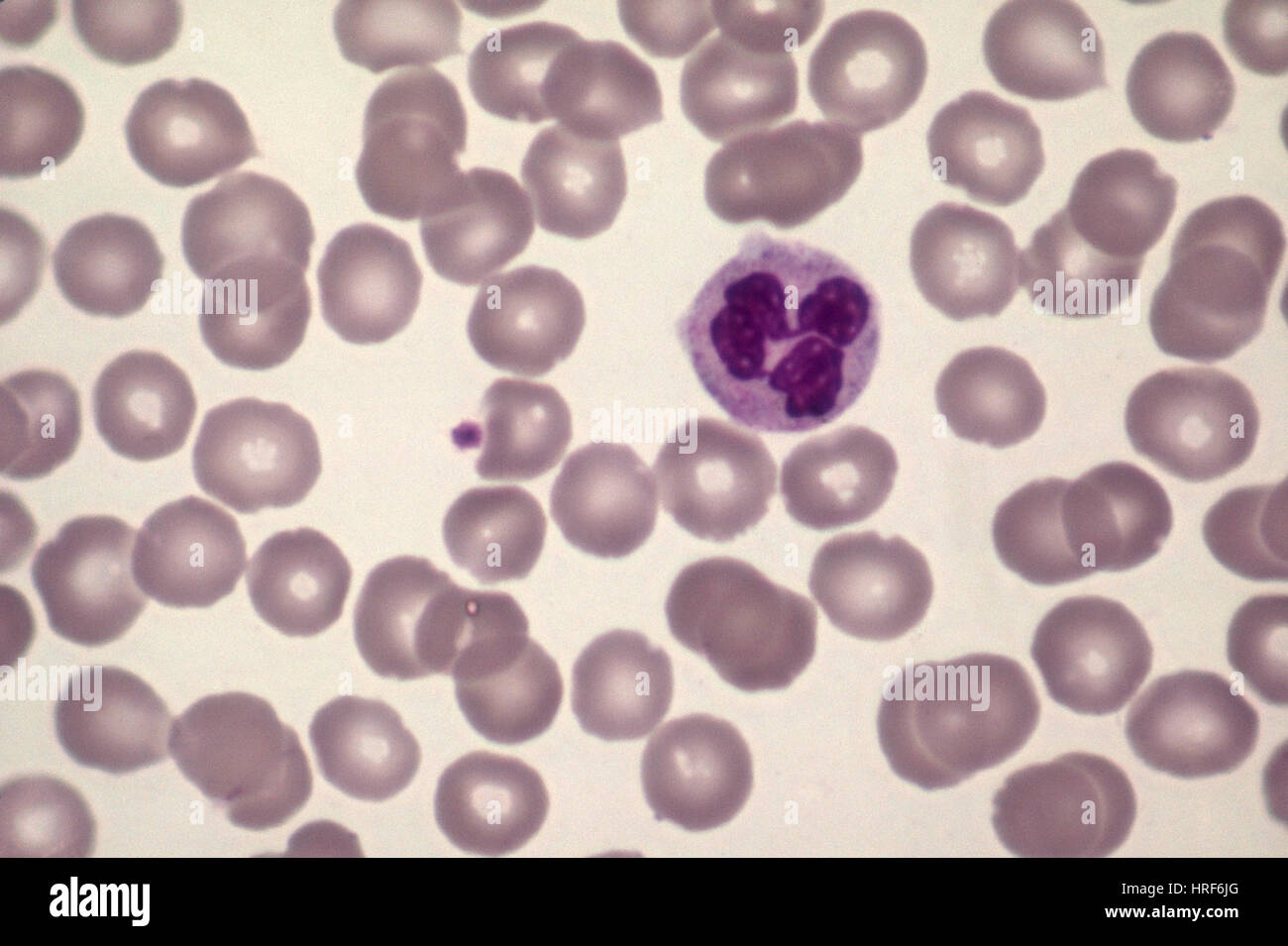 I neutrofili e cellule di sangue rosse (LM) Foto Stock