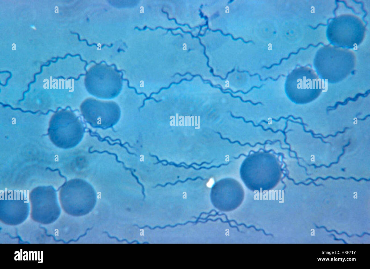 Borrelia recurrentis Foto Stock