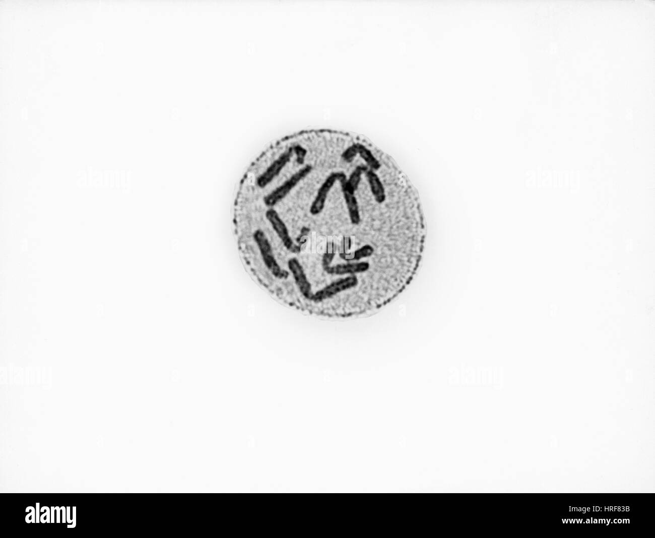 Anaphase di mitosi in Trillium erectum Foto Stock