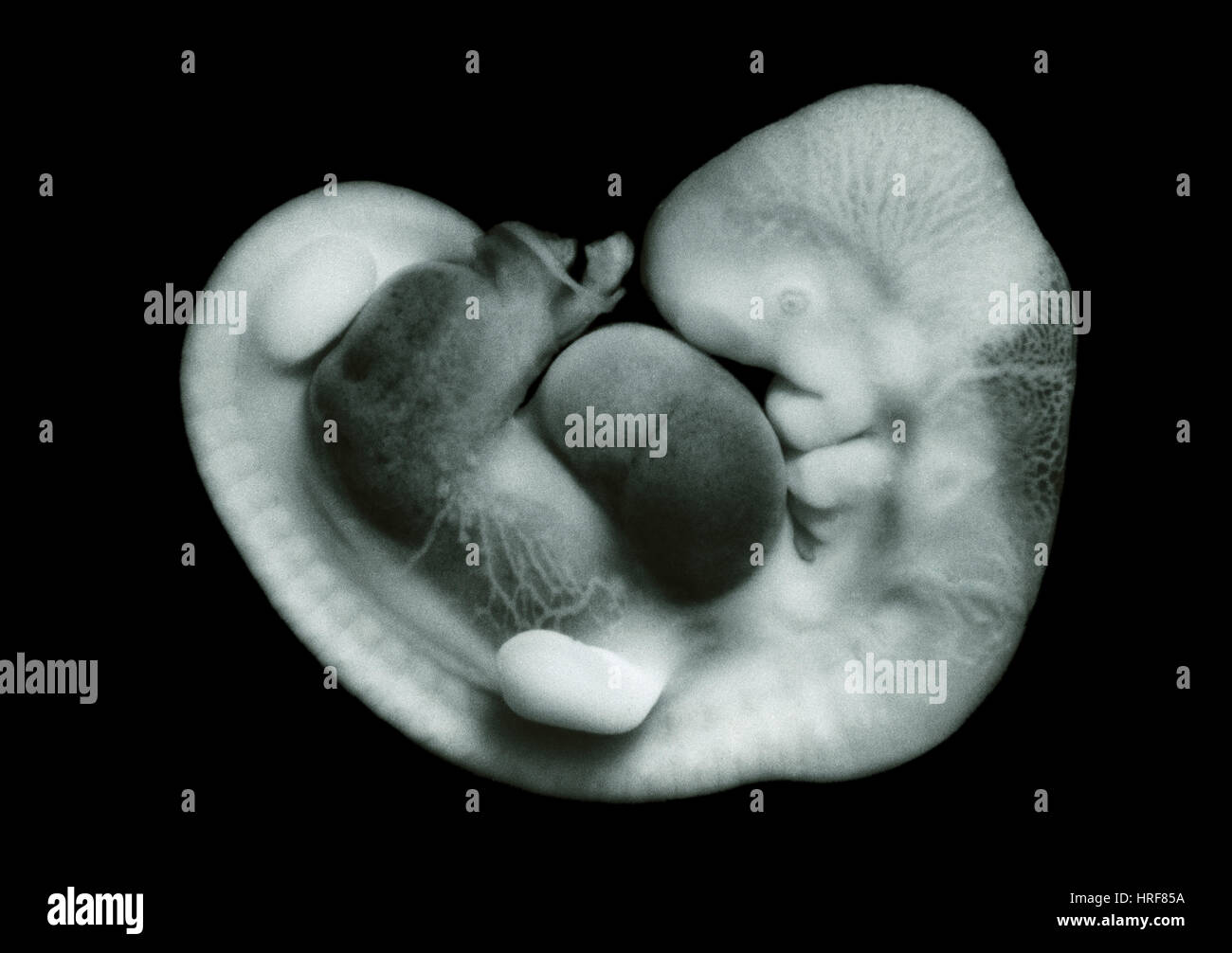 35 giorni di vita embrionale umano Foto Stock