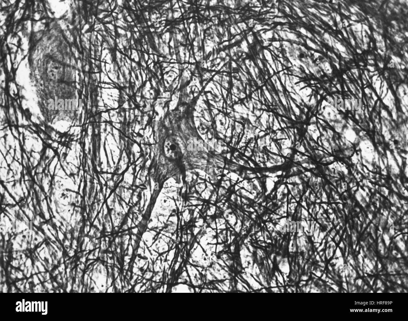 Neuroni motore Cat, Midollo Spinale Foto Stock
