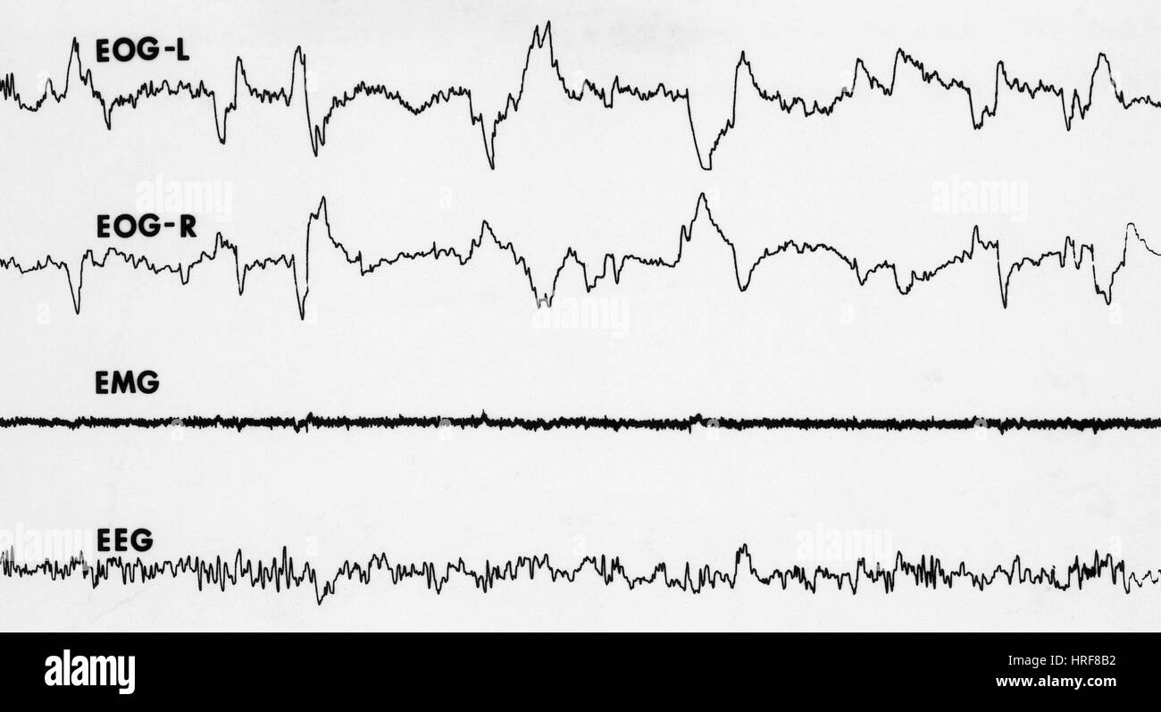 Poligrafo ricalcature del sonno REM Foto Stock