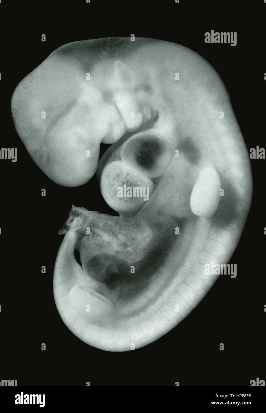30 giorni di vita embrionale umano Foto Stock