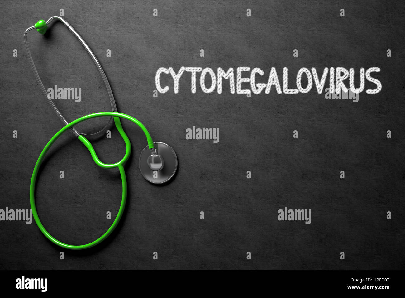 Concetto medico: citomegalovirus - concetto medico sulla lavagna. Concetto medico: citomegalovirus - lavagna nera con disegnati a mano e di testo Foto Stock