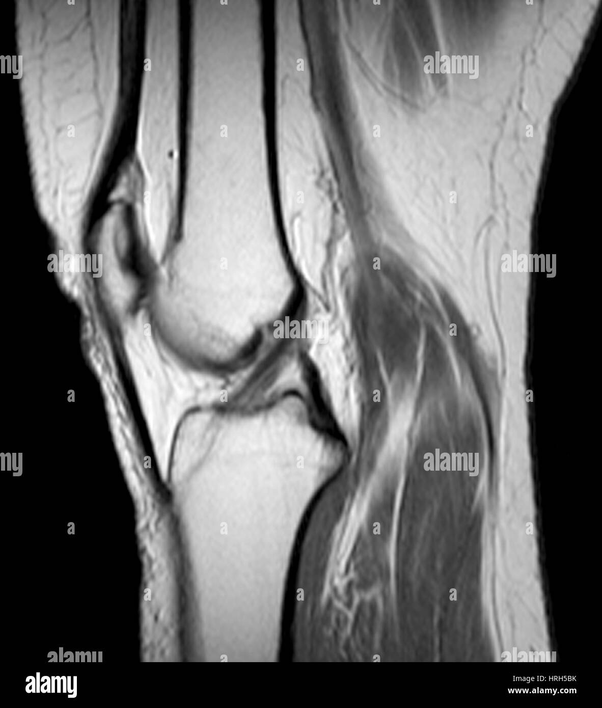 Ginocchio normale Foto Stock