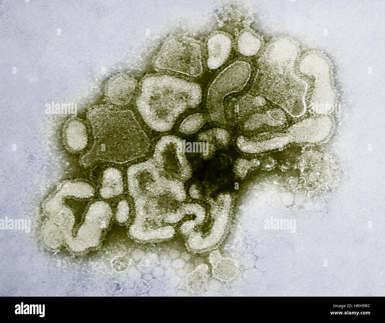 Virus dell'influenza suina Foto Stock