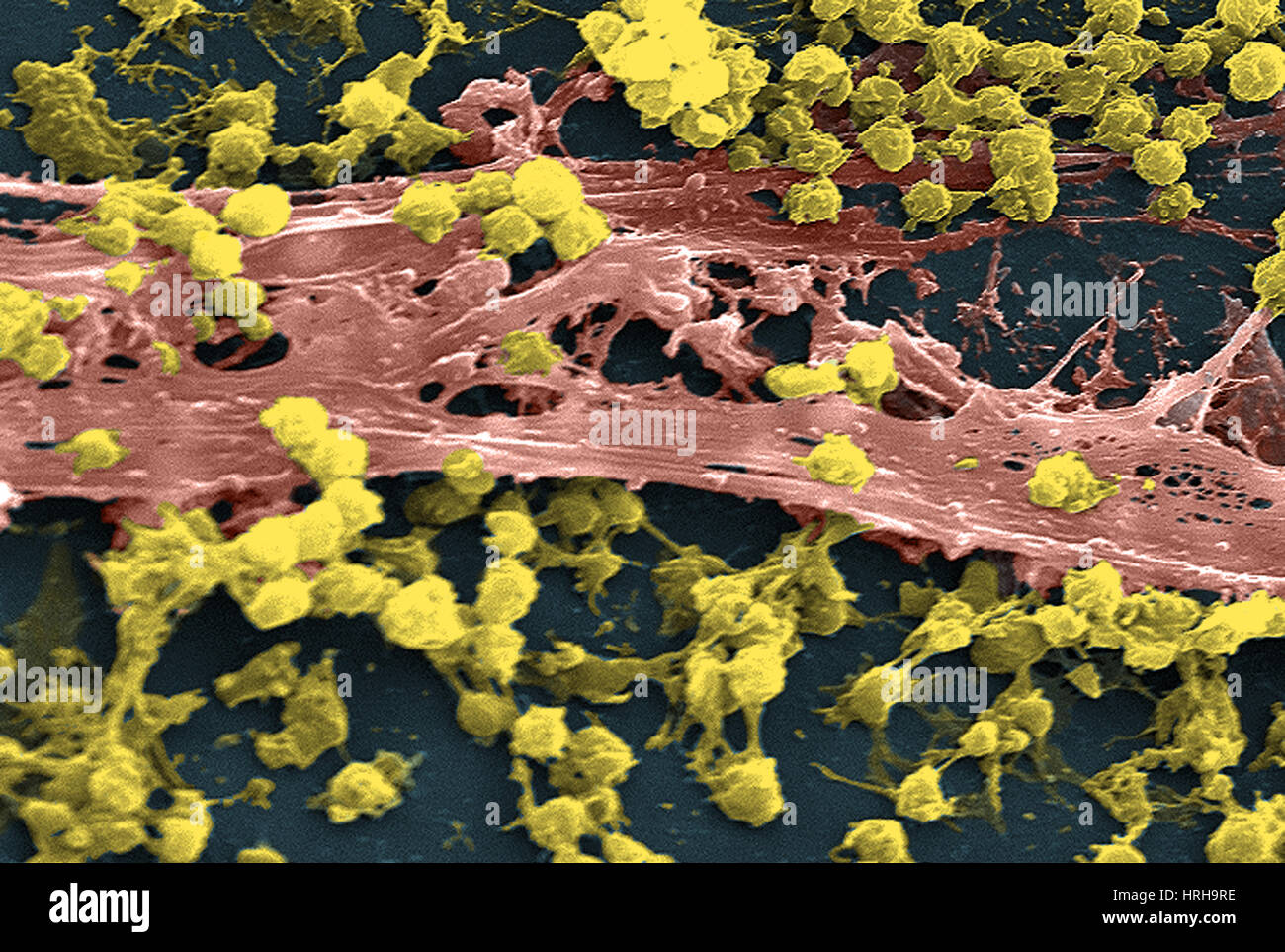 Per Staphylococcus aureus, SEM Foto Stock