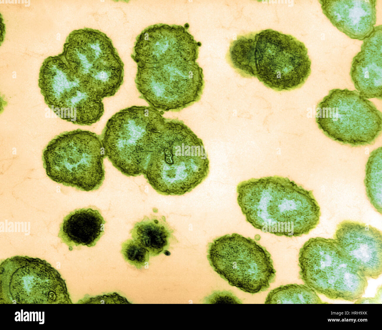 Neisseria gonorrhoeae Foto Stock