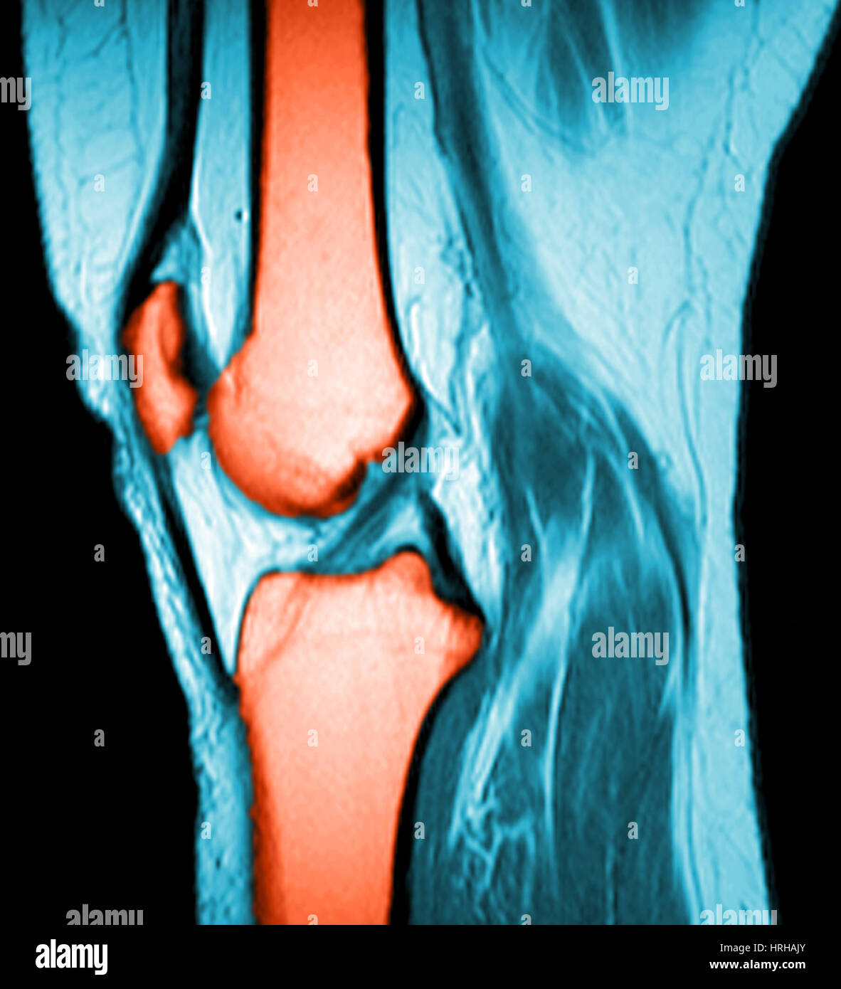Ginocchio normale Foto Stock