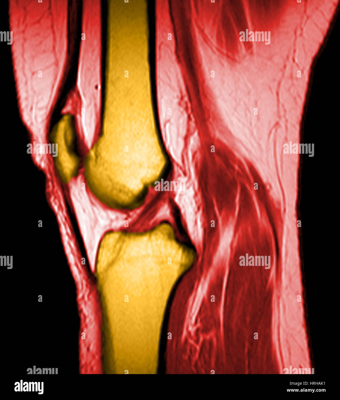 Ginocchio normale Foto Stock
