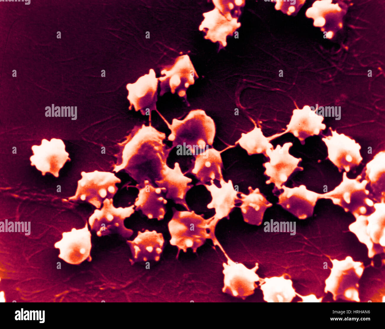 SEM di cellule del sangue di pecora con insufficienza renale Foto Stock