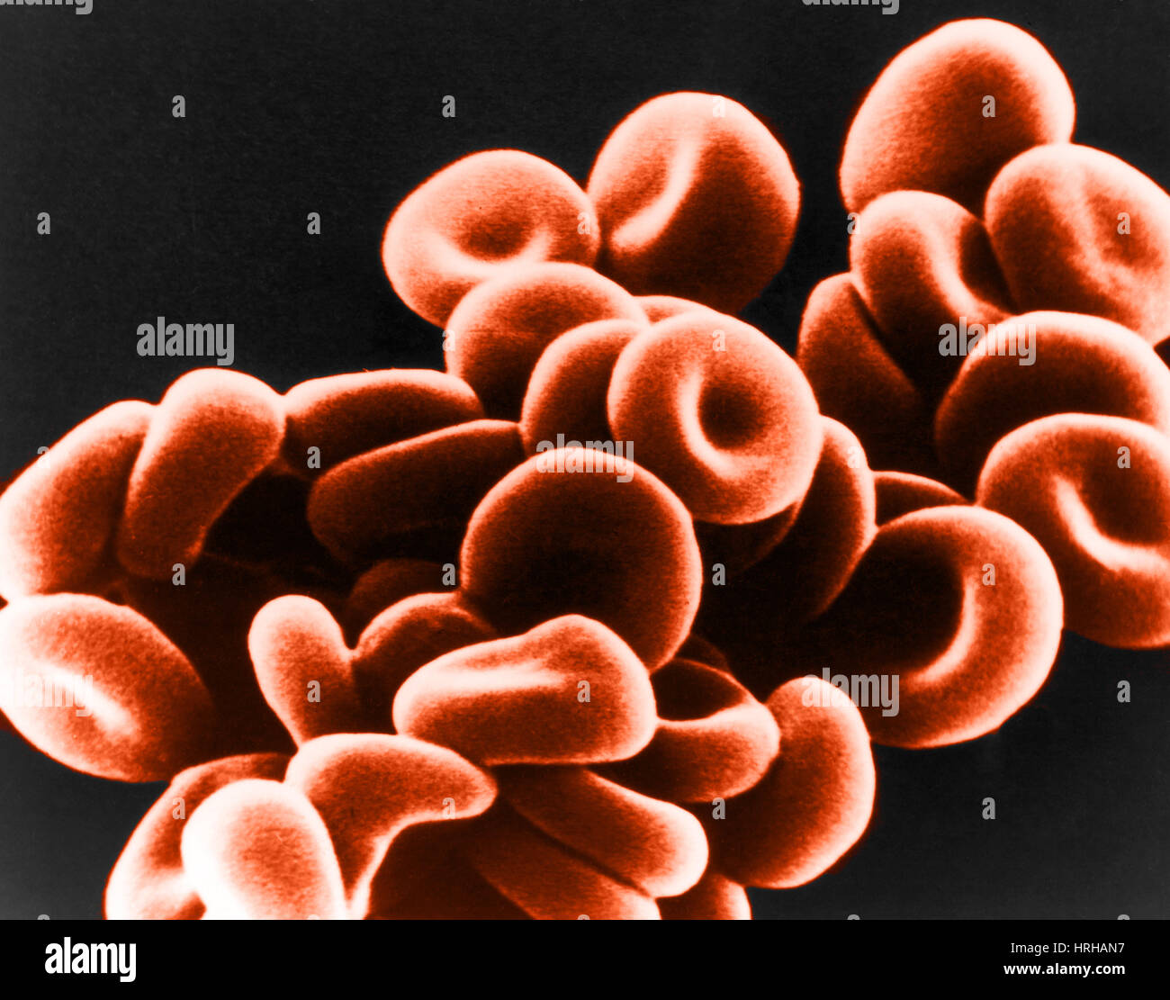 SEM delle normali cellule rosse del sangue negli ovini Foto Stock
