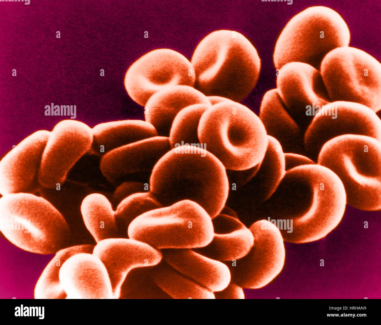 SEM delle normali cellule rosse del sangue negli ovini Foto Stock