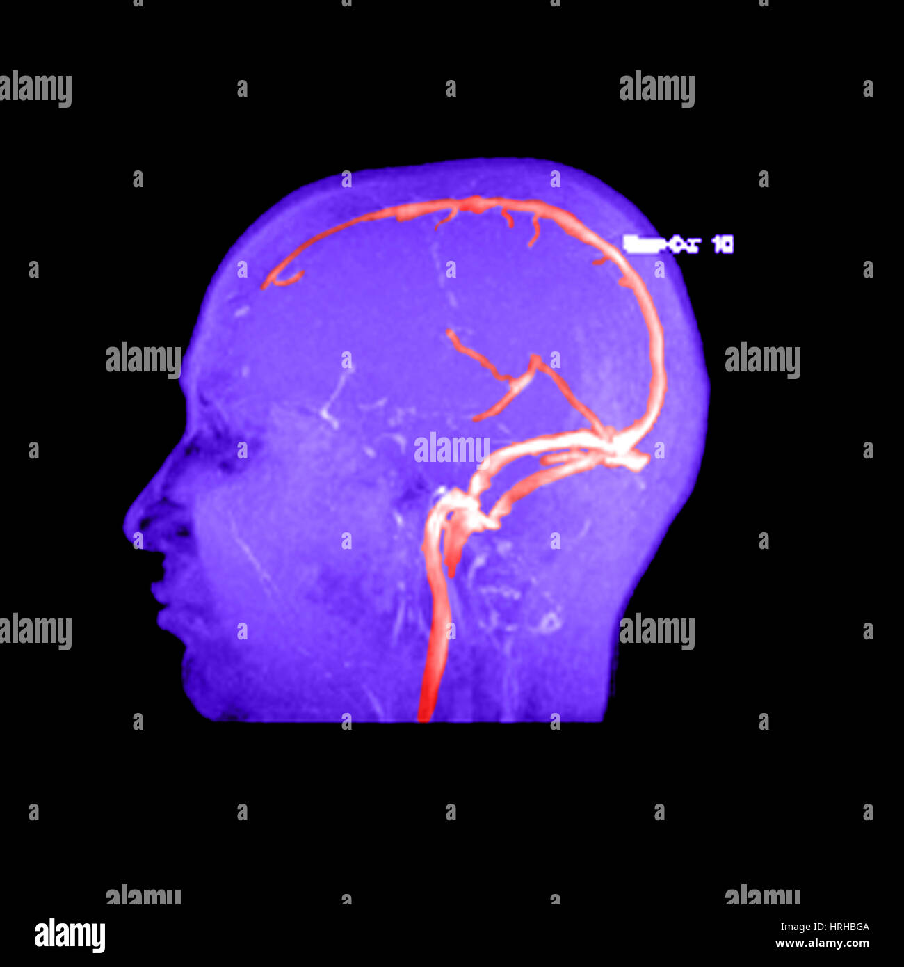La normale anatomia venosa Foto Stock