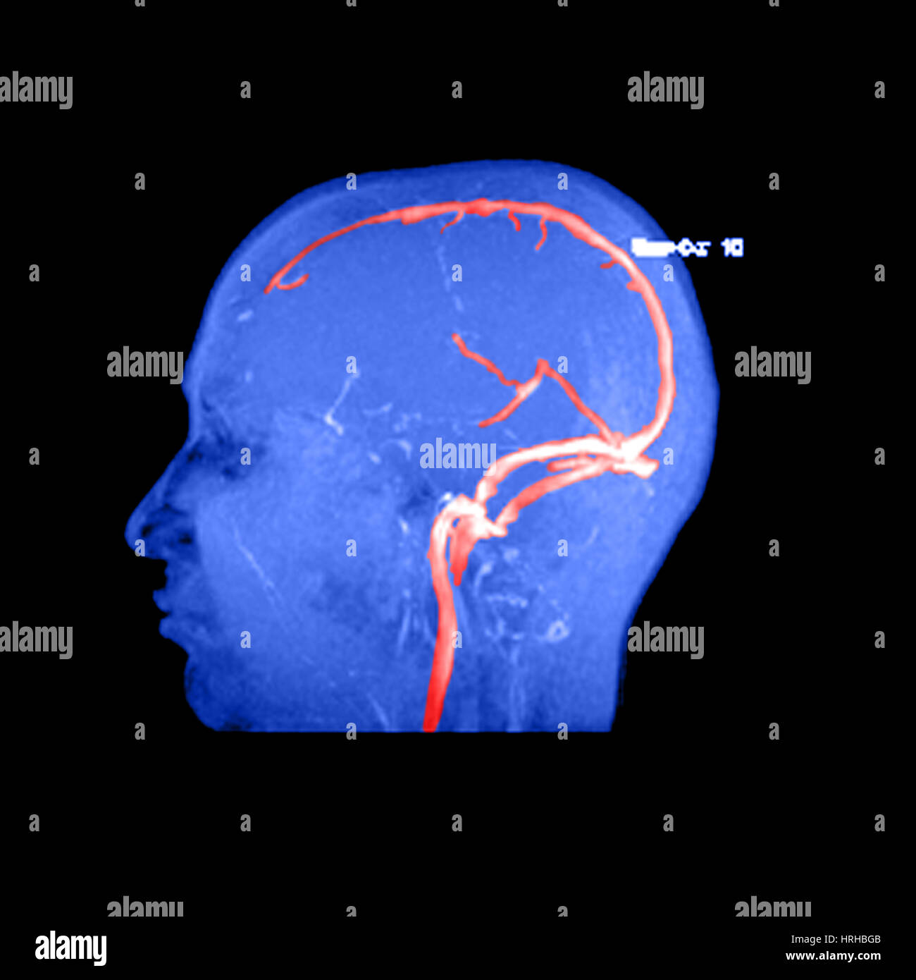 La normale anatomia venosa Foto Stock