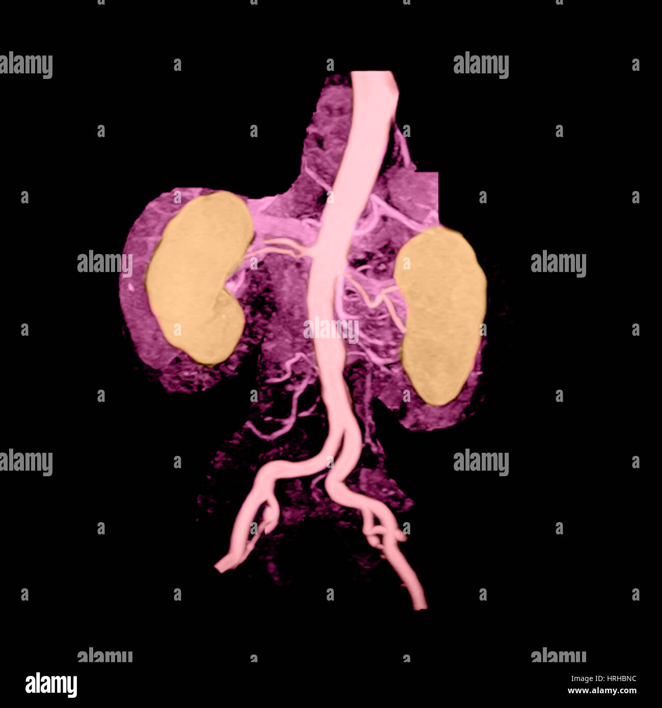 Aorta addominale e i reni Foto Stock