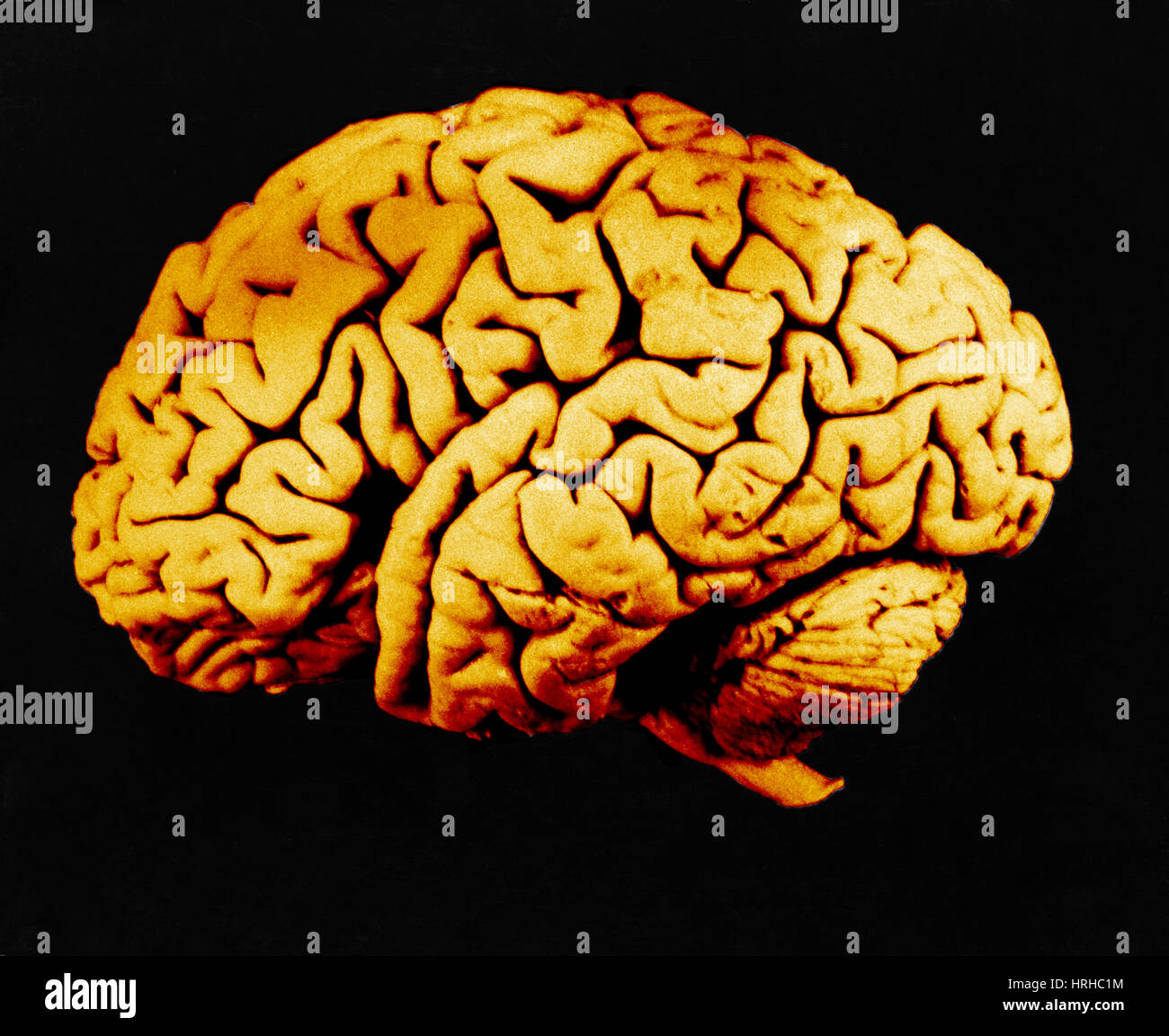 Cervello umano Foto Stock