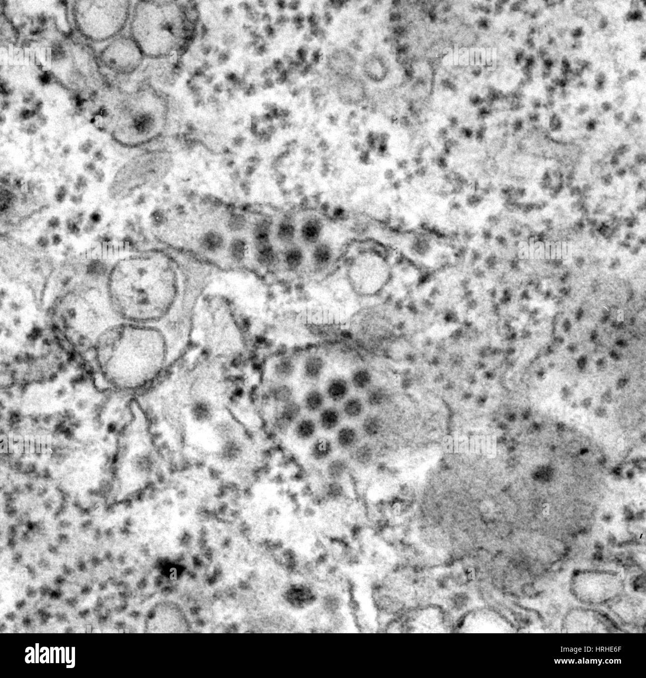 Virus dengue, TEM Foto Stock