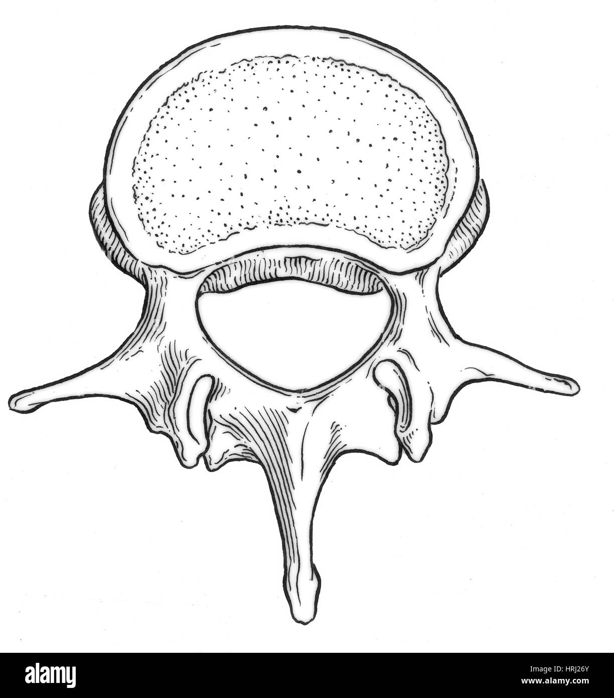 Illustrazione del disco vertebrale Foto Stock