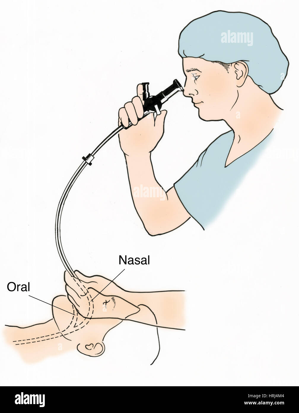 Illustrazione Di Endoscopia Foto Stock