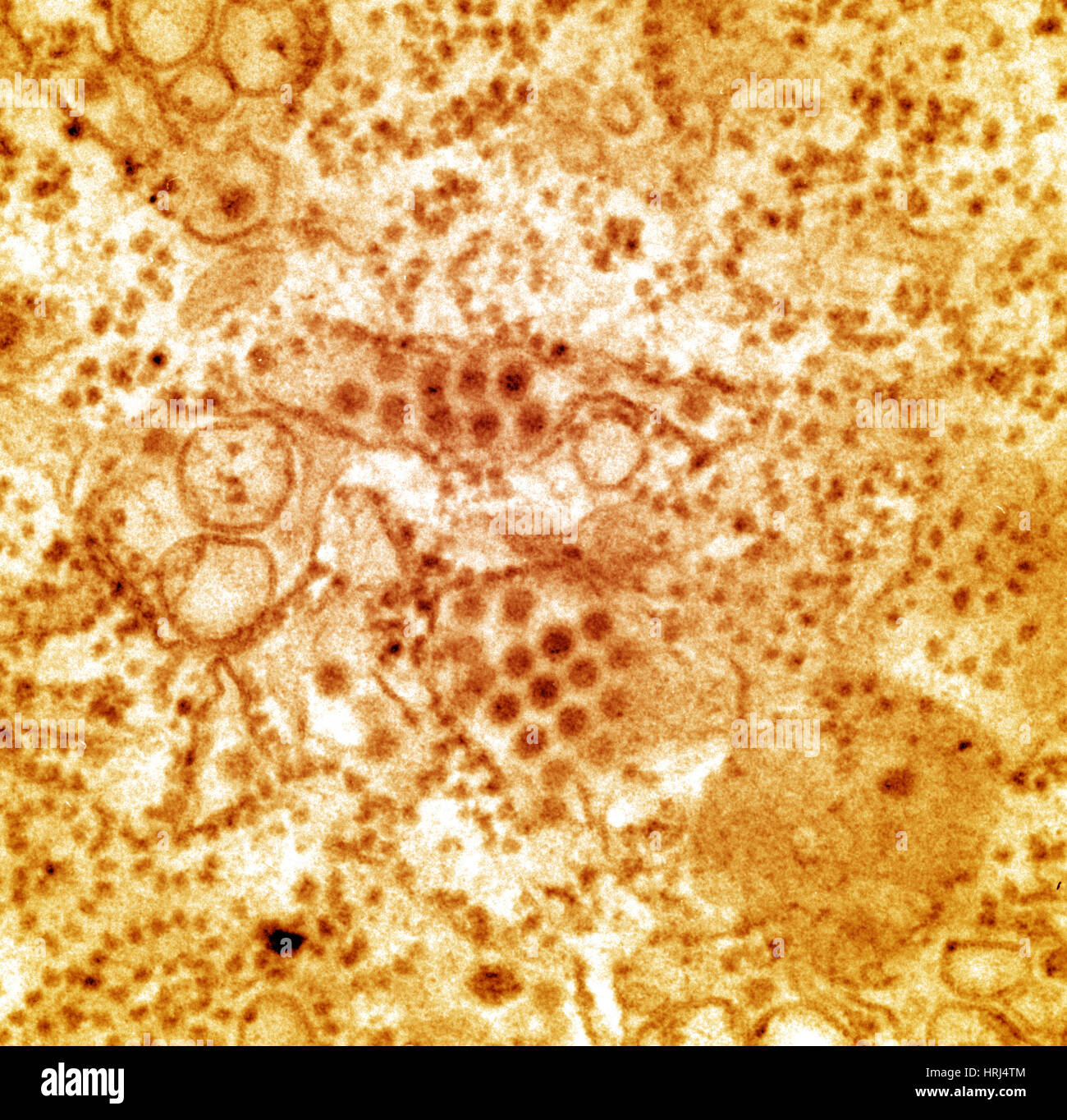 Virus dengue, TEM Foto Stock