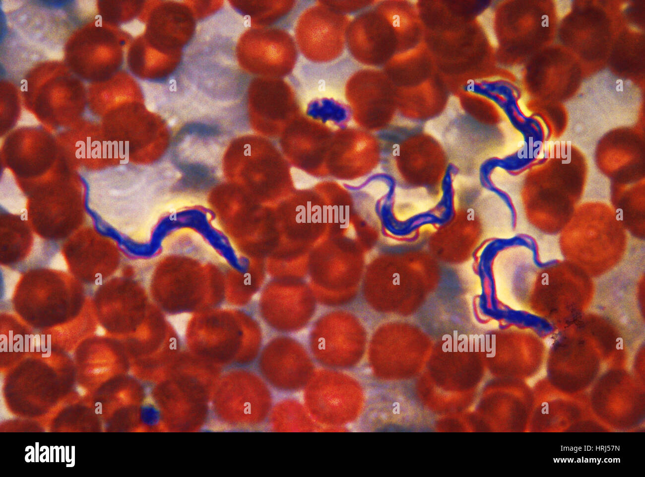 Trypanosoma brucei gambiense, LM Foto Stock