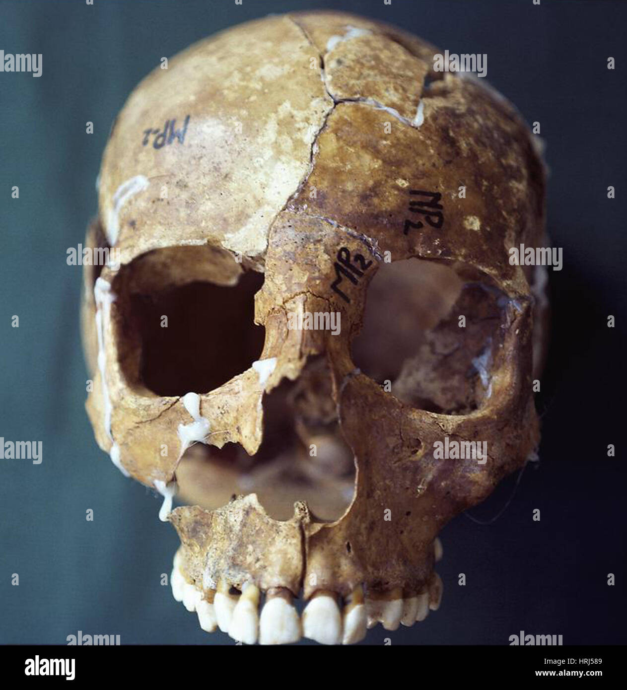 Prove forensi, cranio la ricostruzione Foto Stock