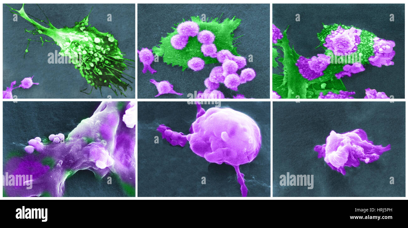 Morte delle cellule cancerogene sem immagini e fotografie stock ad alta ...