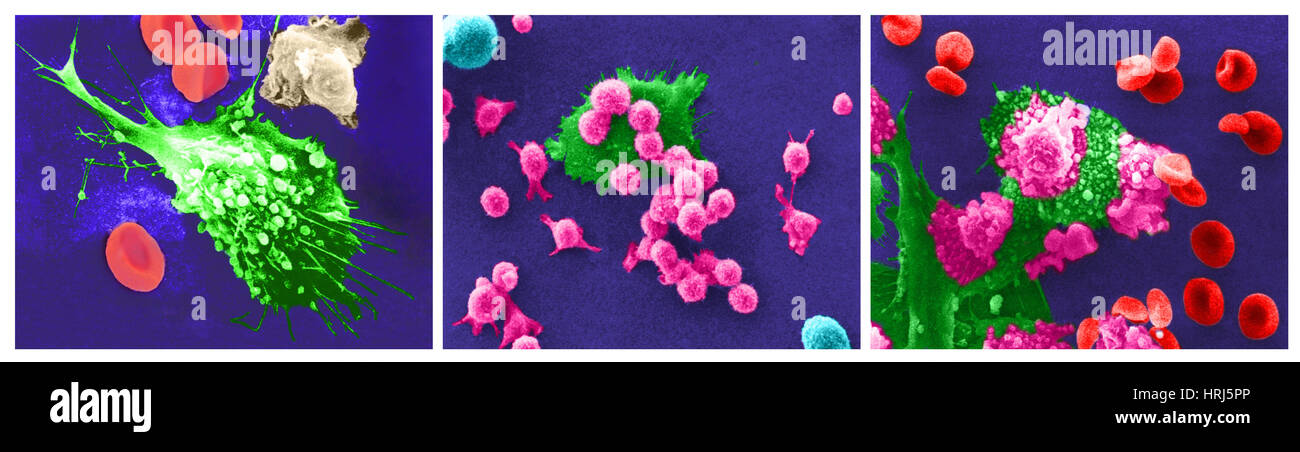 Morte delle cellule cancerogene sem immagini e fotografie stock ad alta ...