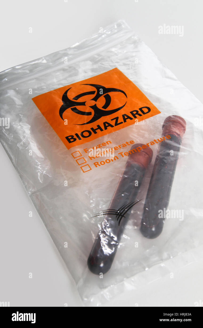 I campioni di sangue in un sacchetto per materiali a rischio biologico Foto Stock