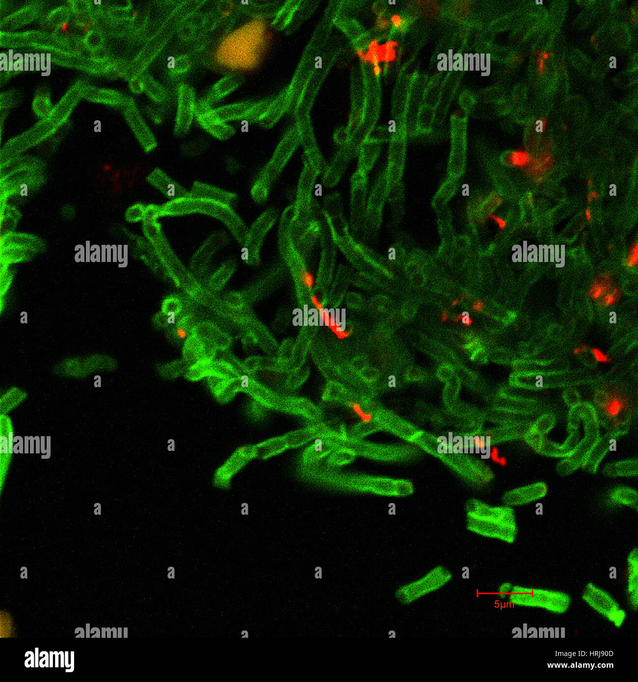 Carbonchio ematico, Bacillus anthracis batteri, CM Foto Stock