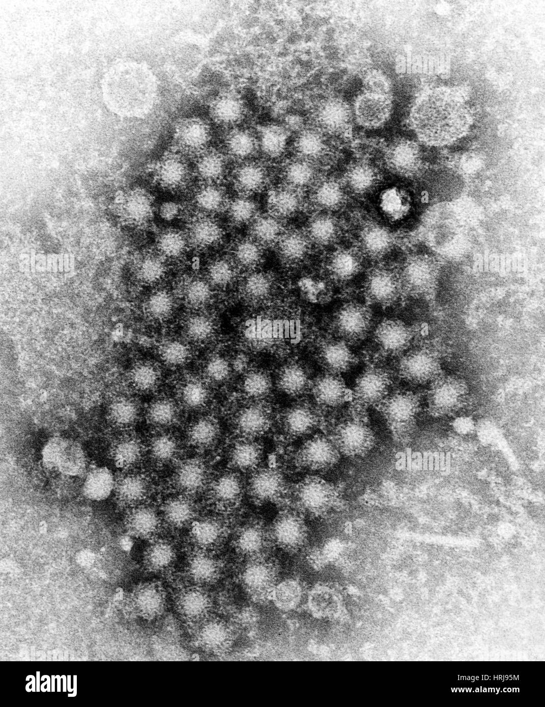 Virus di epatite, ceppo sconosciuto, TEM Foto Stock