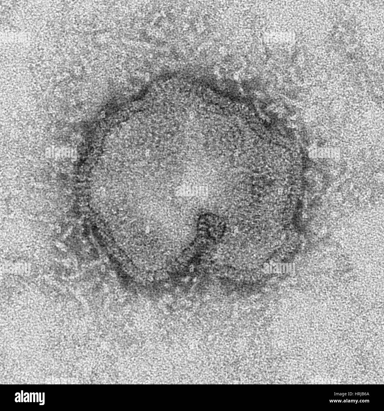 H7N9, influenza A, Virus dell influenza aviaria, TEM Foto Stock
