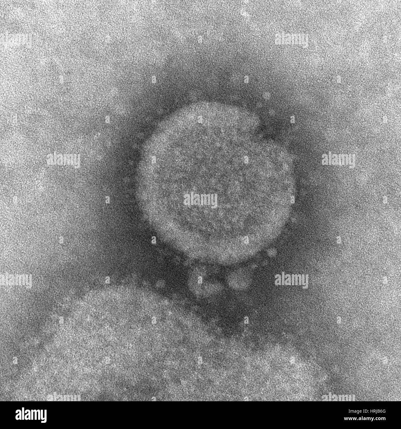 H7N9, influenza A, Virus dell influenza aviaria, TEM Foto Stock