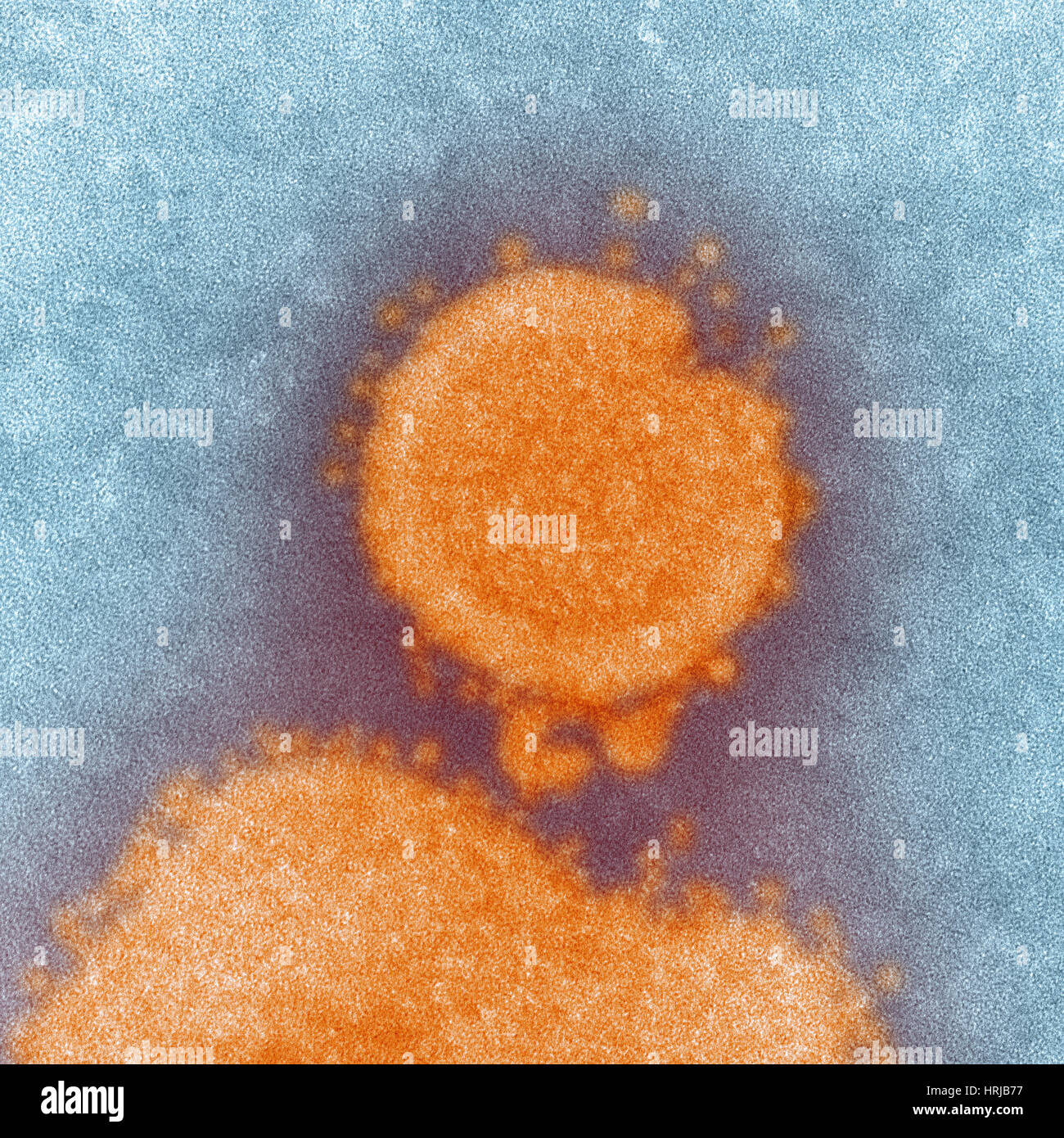 H7N9, influenza A, Virus dell influenza aviaria, TEM Foto Stock